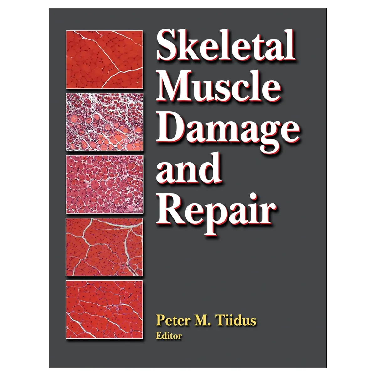 Skeletal Muscle Damage And Repair Pdf 1